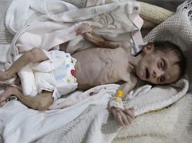 子ども数百人が飢餓に直面　シリア