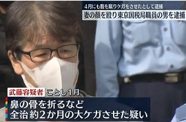 東京国税局職員が女性の顔殴る　全治2か月